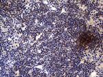 TNFRSF8 Antibody in Immunohistochemistry (Paraffin) (IHC (P))
