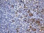 TNFRSF8 Antibody in Immunohistochemistry (Paraffin) (IHC (P))