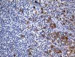 TNFRSF8 Antibody in Immunohistochemistry (Paraffin) (IHC (P))