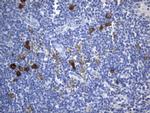 TNFRSF8 Antibody in Immunohistochemistry (Paraffin) (IHC (P))