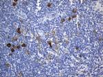 TNFRSF8 Antibody in Immunohistochemistry (Paraffin) (IHC (P))