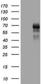 TNFRSF8 Antibody in Western Blot (WB)