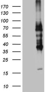 TNFRSF8 Antibody in Western Blot (WB)
