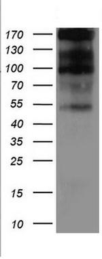 TNFRSF8 Antibody in Western Blot (WB)