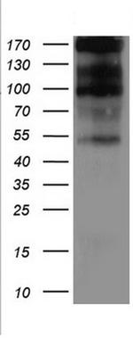 TNFRSF8 Antibody in Western Blot (WB)