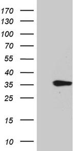 TNFSF10 Antibody in Western Blot (WB)