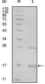 TNK1 Monoclonal Antibody (1B5G3;3F11H6)
