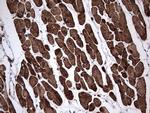 TNNC1 Antibody in Immunohistochemistry (Paraffin) (IHC (P))