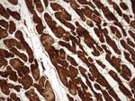 TNNC1 Antibody in Immunohistochemistry (Paraffin) (IHC (P))