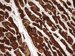 TNNC1 Antibody in Immunohistochemistry (Paraffin) (IHC (P))