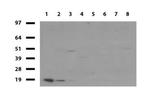 TNNC1 Antibody in Western Blot (WB)