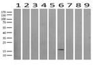 TNNC1 Antibody in Western Blot (WB)