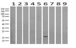 TNNC1 Antibody in Western Blot (WB)