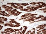 TNNI1 Antibody in Immunohistochemistry (Paraffin) (IHC (P))