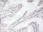 TNNI3 Antibody in Immunohistochemistry (Paraffin) (IHC (P))