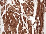 TNNI3 Antibody in Immunohistochemistry (Paraffin) (IHC (P))