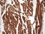 TNNI3 Antibody in Immunohistochemistry (Paraffin) (IHC (P))