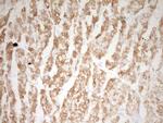 TNNI3 Antibody in Immunohistochemistry (Paraffin) (IHC (P))