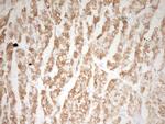 TNNI3 Antibody in Immunohistochemistry (Paraffin) (IHC (P))