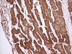 TNNI3 Antibody in Immunohistochemistry (Paraffin) (IHC (P))