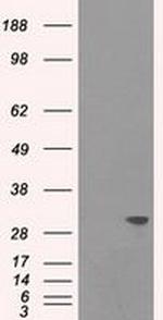 TNNI3 Antibody in Western Blot (WB)