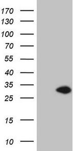 TNNI3 Antibody in Western Blot (WB)
