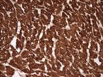 TNNT2 Antibody in Immunohistochemistry (Paraffin) (IHC (P))