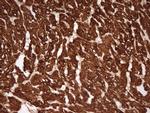 TNNT2 Antibody in Immunohistochemistry (Paraffin) (IHC (P))