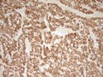 TNNT2 Antibody in Immunohistochemistry (Paraffin) (IHC (P))
