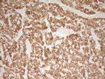 TNNT2 Antibody in Immunohistochemistry (Paraffin) (IHC (P))
