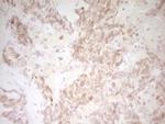TNNT2 Antibody in Immunohistochemistry (Paraffin) (IHC (P))