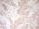 TNNT2 Antibody in Immunohistochemistry (Paraffin) (IHC (P))