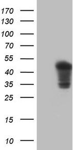 TNNT2 Antibody in Western Blot (WB)