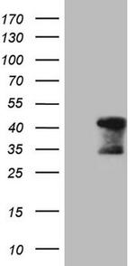 TNNT2 Antibody in Western Blot (WB)