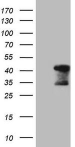 TNNT2 Antibody in Western Blot (WB)