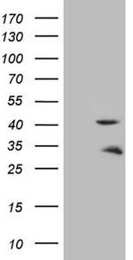 TNNT2 Antibody in Western Blot (WB)