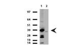 TNNT2 Antibody in Western Blot (WB)