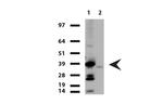 TNNT2 Antibody in Western Blot (WB)