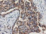 TOMM34 Antibody in Immunohistochemistry (Paraffin) (IHC (P))