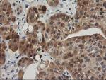 TOMM34 Antibody in Immunohistochemistry (Paraffin) (IHC (P))
