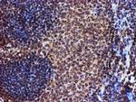 TOMM34 Antibody in Immunohistochemistry (Paraffin) (IHC (P))