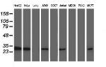 TOMM34 Antibody in Western Blot (WB)