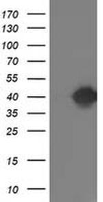 TOMM34 Antibody in Western Blot (WB)