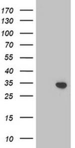 TOMM34 Antibody in Western Blot (WB)