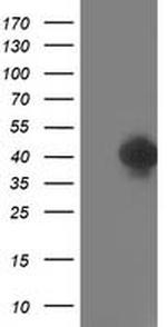 TOMM34 Antibody in Western Blot (WB)
