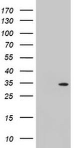 TOMM34 Antibody in Western Blot (WB)