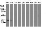 TOMM34 Antibody in Western Blot (WB)