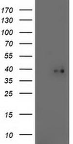 TOMM34 Antibody in Western Blot (WB)