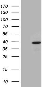 TOMM40L Antibody in Western Blot (WB)