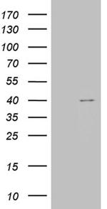 TOMM40L Antibody in Western Blot (WB)